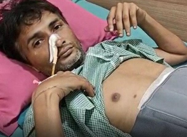 Розлючений чоловік проковтнув 28 ложок і 19 зубних щіток: що сталося (фото)