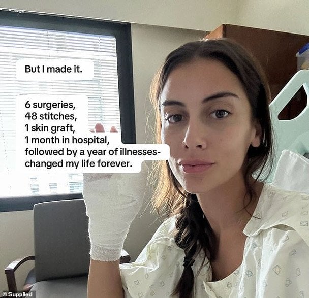 Жінка сходила на манікюр і ледь не померла: довелось ампутувати палець