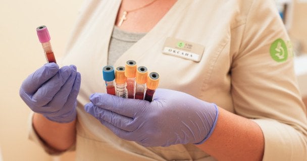 Сучасна діагностика діабету: від перших аналізів до розширених програм у CSD LAB