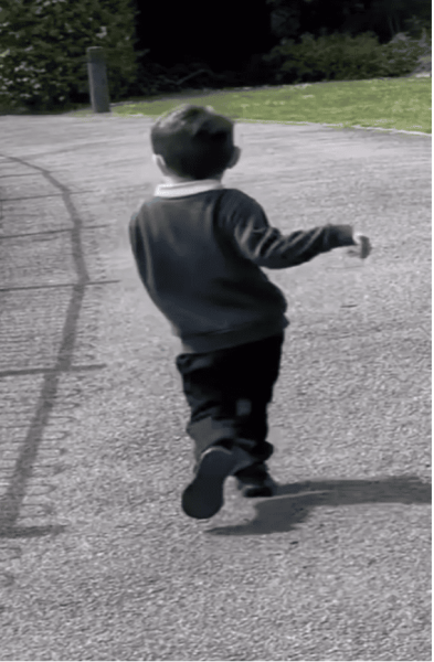 Лікарі звинувачували в симуляції: шокувальна історія хлопчика з вікторіанською хворобою