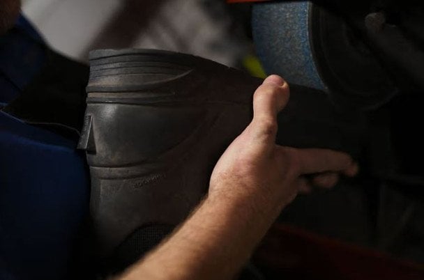 Швець відрізав палець і отримав новий із ноги: який вигляд має його рука (фото)