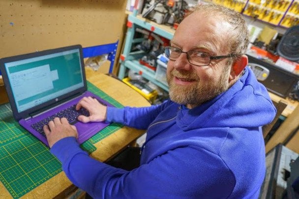 Швець відрізав палець і отримав новий із ноги: який вигляд має його рука (фото)