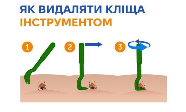 Кліщ уже вчепився, а лікарні немає: як правильно видалити та чого робити категорично не можна