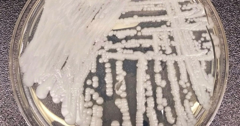 Штам Candida auris. Фото: Бібліотека зображень у сфері громадського здоров’я (PHIL) Центрів з контролю та профілактики захворювань (CDC) під ідентифікаційним номером #21796